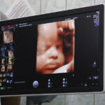 Nowa poradnia w szpitalu wojewódzkim (17 sierpnia 2015 r.) / Piotr Michalski / Radio Kielce