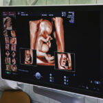 Nowa poradnia w szpitalu wojewódzkim (17 sierpnia 2015 r.) / Piotr Michalski / Radio Kielce