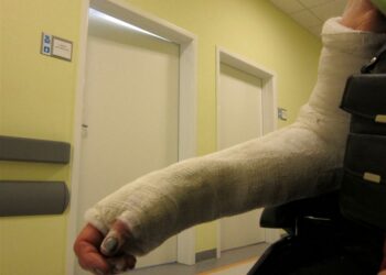 Złamana ręka, gips, ortopedia / Robert Felczak / Radio Kielce
