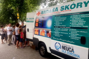 21.07.2017 Kielce. Badanie skóry w mobilnej klinice na Barwinku. / Iwona Murawska / Radio Kielce