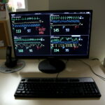 Nowy sprzęt dla klinik w szpitalu na Czarnowie / Marzena Mąkosa / Radio Kielce