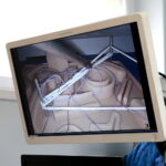 Pierwsze ogólnopolskie warsztaty laparoskopii ginekologicznej dla młodych ginekologów onkologów w Świętokrzyskim Centrum Onkologii. Ćwiczenia w ŚCO / Marzena Mąkosa / Radio Kielce