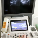 Bezpłatne badania profilaktyczne z okazji Dni Otwartych Funduszy Europejskich / Marzena Mąkosa / Radio Kielce