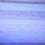 Supernowoczesny, przenośny aparat KTG w Świętokrzyskim Centrum Matki i Noworodka / Iwona Murawska / Radio Kielce