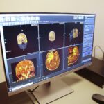 Kielce. 25.11.2019. Otwarcie Centrum symulacji radioterapii na UJK / Wiktor Taszłow / Radio Kielce