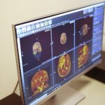 Kielce. 25.11.2019. Otwarcie Centrum symulacji radioterapii na UJK / Wiktor Taszłow / Radio Kielce