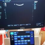 05.12.2019 Busko-Zdrój. Aparat ginekologiczny USG w buskim szpitalu / Szpital Busko -Zdrój