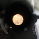 18.02.2021 Starachowice. Zakład patomorfologii przy szpitalu powiatowym. Komórki zdrowe widziane pod mikroskopem / Jarosław Kubalski / Radio Kielce