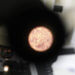 18.02.2021 Starachowice. Zakład patomorfologii przy szpitalu powiatowym. Komórki rakowe widziane pod mikroskopem / Jarosław Kubalski / Radio Kielce