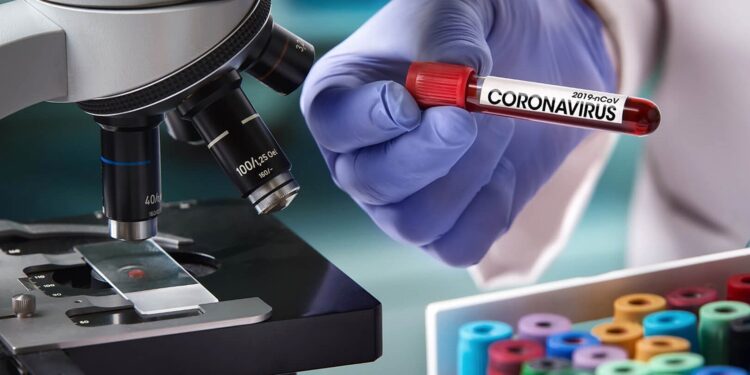 koronawirus, test, covid / stock.adobe.com