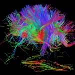 Human Connectome Project