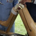 01.09.2021. Kielce. Warsztaty z wszczepiania nowoczesnych endoprotez stawu kolanowego / Anna Kwapisz / Radio Kielce