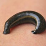 pijawka. pijawki / pixabay.pl