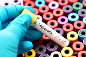 Legionelloza to niebezpieczna choroba zakaźna powodowana przez bakterie z rodzaju Legionella / źródło: gov.pl
