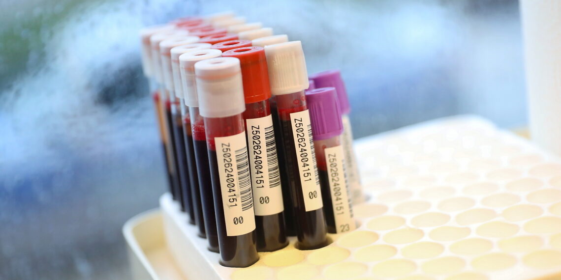 Krwiobus cały czas w trasie. Brakuje niemal wszystkich grup krwi