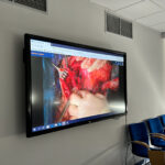 28.06.2024. Kielce. ŚCO. Warsztaty - „Chirurgiczna rehabilitacja głosu po całkowitej laryngektomii” / Fot. Daniel Czwartosz - Radio Kielce