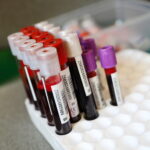 Przyjadą po twoją krew