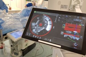 18.06.2025. Starachowice. Warsztaty w pracowni hemodynamiki / Fot. Szpital Starachowice