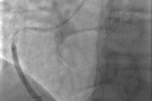 Sandomierz. Szpital w Sandomierzu. Zabieg / Fot. Szpital w Sandomierzu