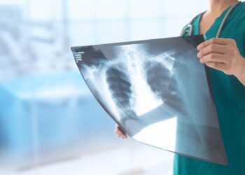 Nauczycielka z gruźlicą, uczniowie do diagnozy