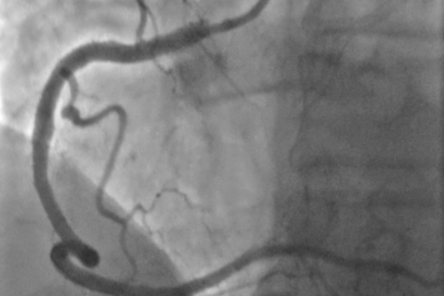 Nowoczesna kardiologia w sandomierskim szpitalu