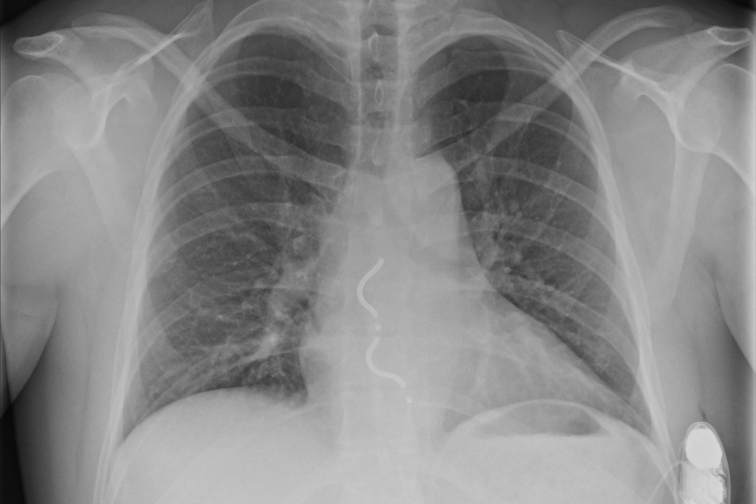 Nowatorski zabieg w Świętokrzyskim Centrum Kardiologii