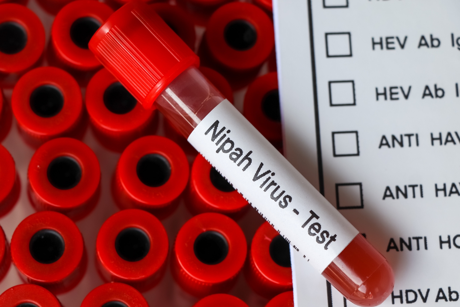 Nipah – kolejny wirus nietoperzy