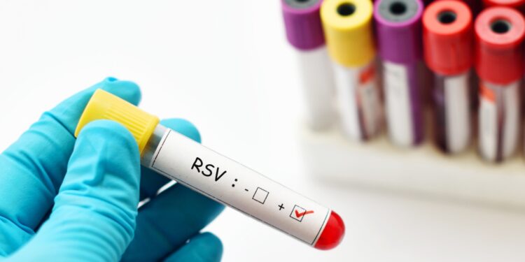 RSV to groźny wirus dla seniorów. Warto się zaszczepić nawet po przebyciu infekcji