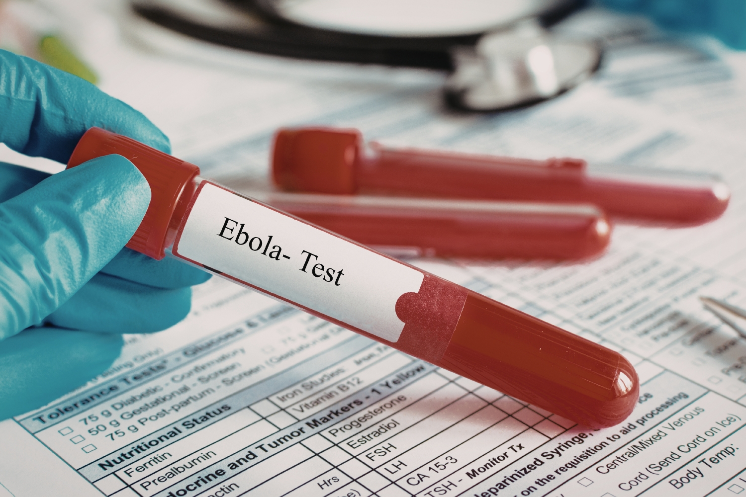 Ebola gwałtownie się rozprzestrzenia. GIS: sytuacja jest poważna
